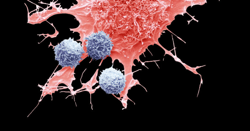 CAR-T, Lifesaving Cancer Treatment, May Sometimes Cause Cancer, FDA Says